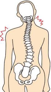 骨盤の歪み・捻じれが肩こりや腰痛の原因となります。